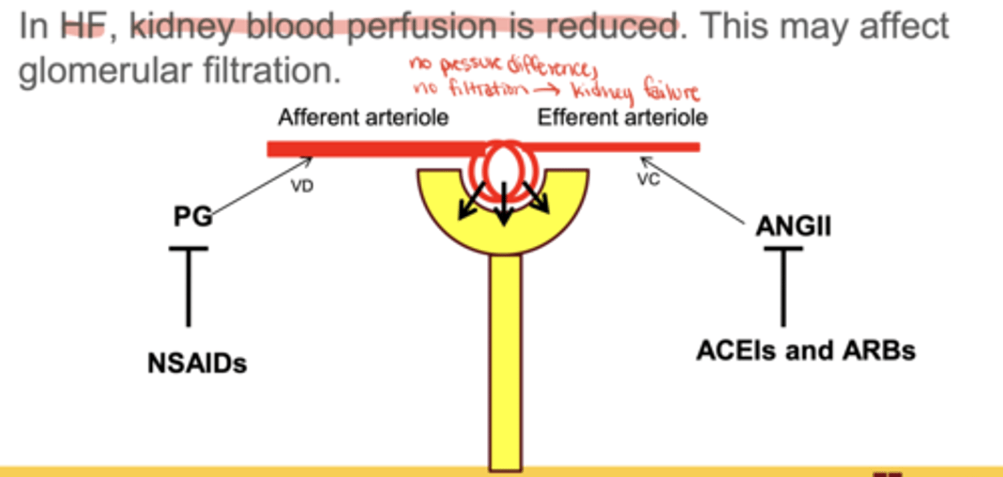<p>loss of afferent vasodilation + efferent vasoconstriction → ↓ GFR → acute kidney injury</p>