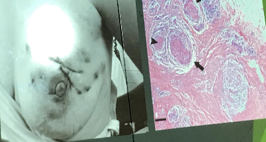 <p>diagnostico</p>