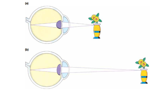 <p><span>●involves <strong>the automatic focusing mechanism of the lens in the eye to adjust the shape of the lens in response to differing distances of view from the object.</strong></span></p><p></p>