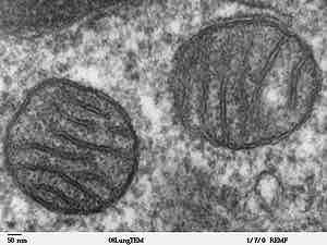 <p style="text-align: center"><strong>elementy mitochondrium</strong></p>