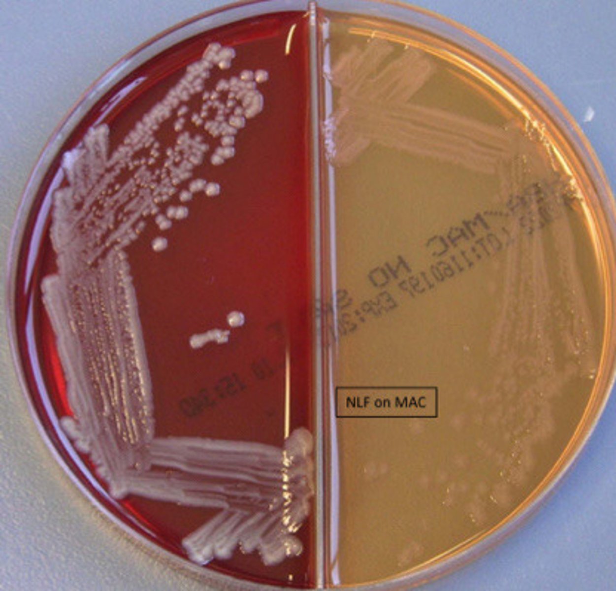 <p>GNB, catalase pos, oxidase neg, indole pos, PYR neg</p>