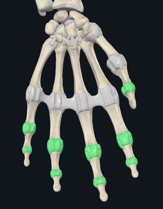 <p>What joint is this</p>