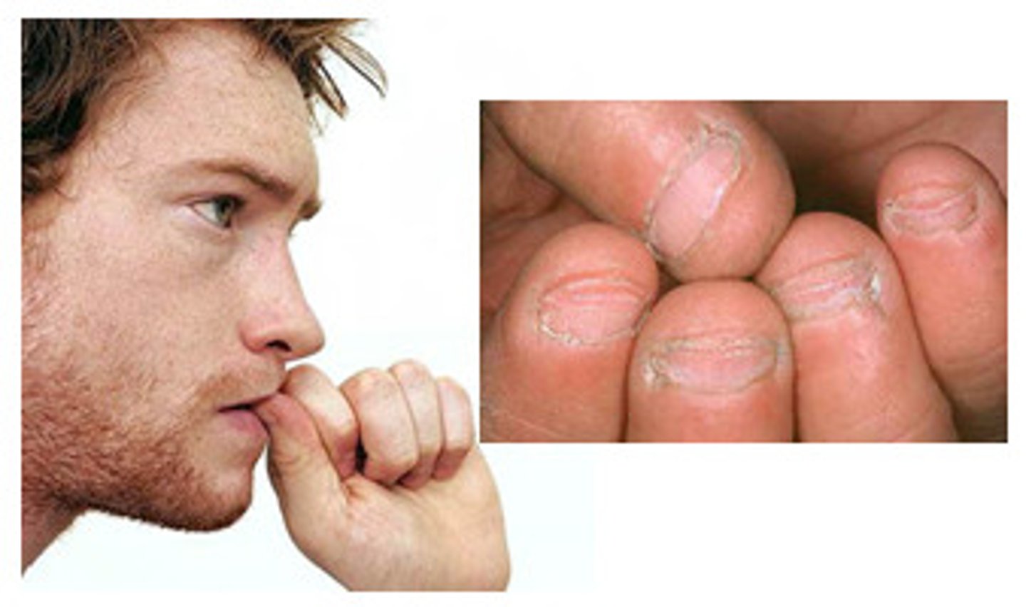 <p>(n.) a natural inclination or predilection toward</p><p>SYNONYMS: natural bent, proclivity, penchant</p><p>ANTONYMS: natural incapacity or inability</p>