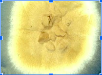 <p>This organism was isolated from an inflammatory lesion of the skin from the scalp of a young male athlete. Pictured below is the organism on sab dex agar and a lactophenol blue mount. Based on these observations, what is the presumptive identification of the fungus?</p>