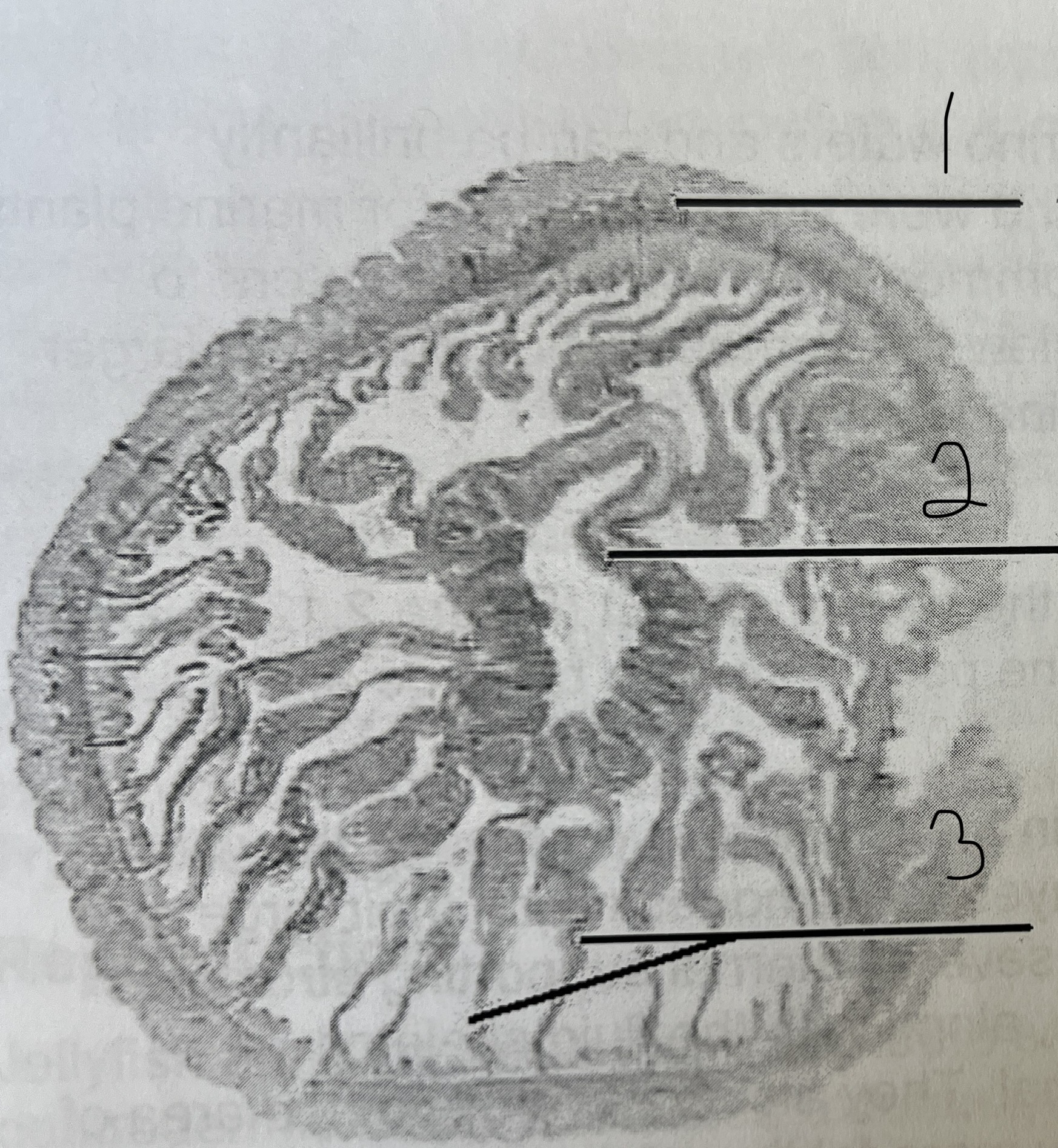 3 Metridium (anemones class anthozoa) cross section