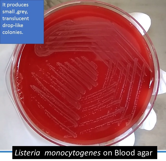 <p>Kolonije su 1 mm, glatke, sjajne, prozirne, uska zona beta hemolize</p>
