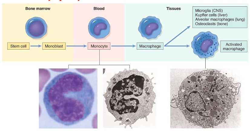 <ul><li><p><span><strong>Macrophages</strong></span></p></li><li><p><span><strong>Lymphocytes</strong></span></p></li><li><p><span><strong>Plasma</strong></span></p></li></ul><p></p>