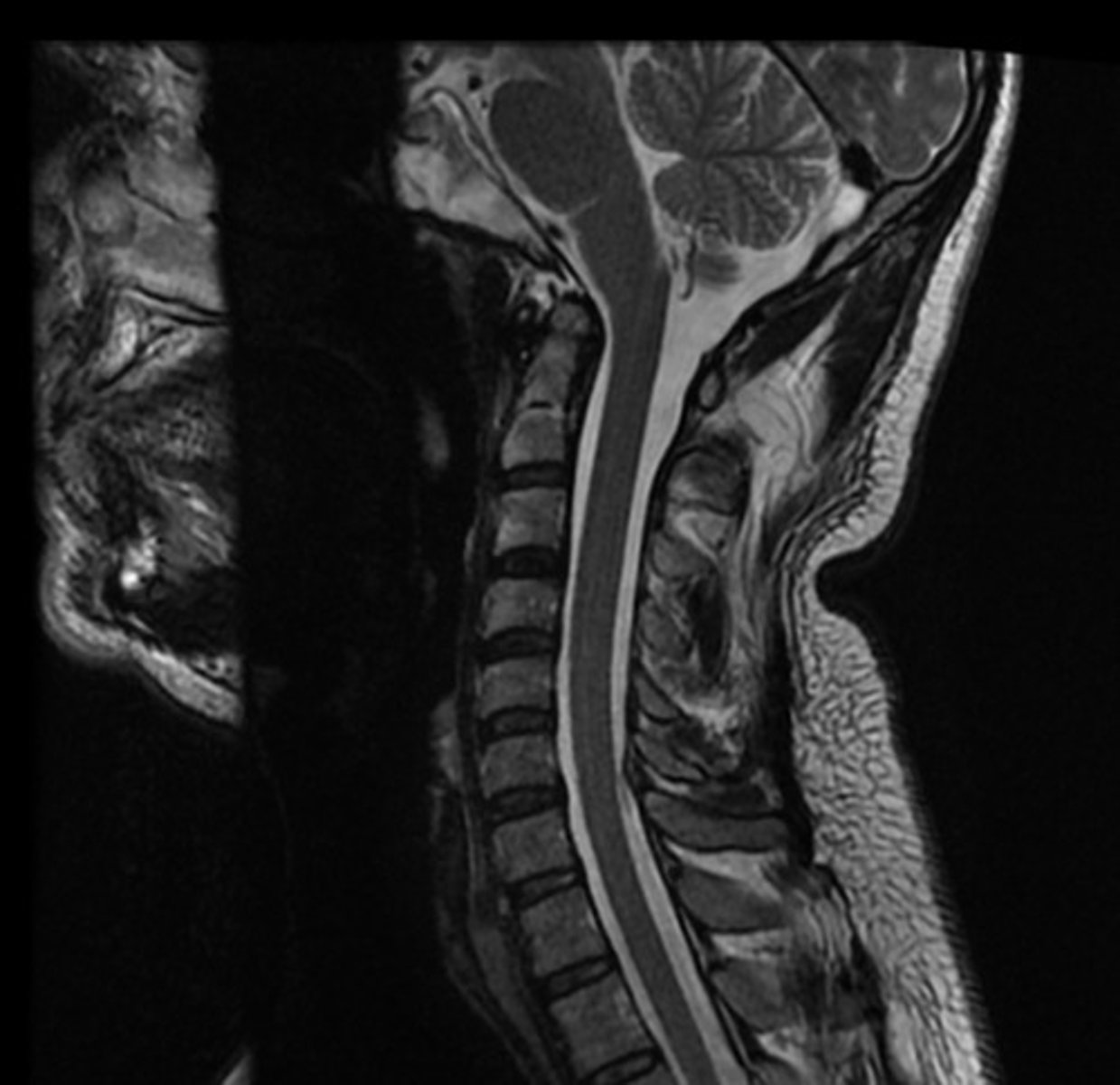 <p>What MRI sequence is this?</p>