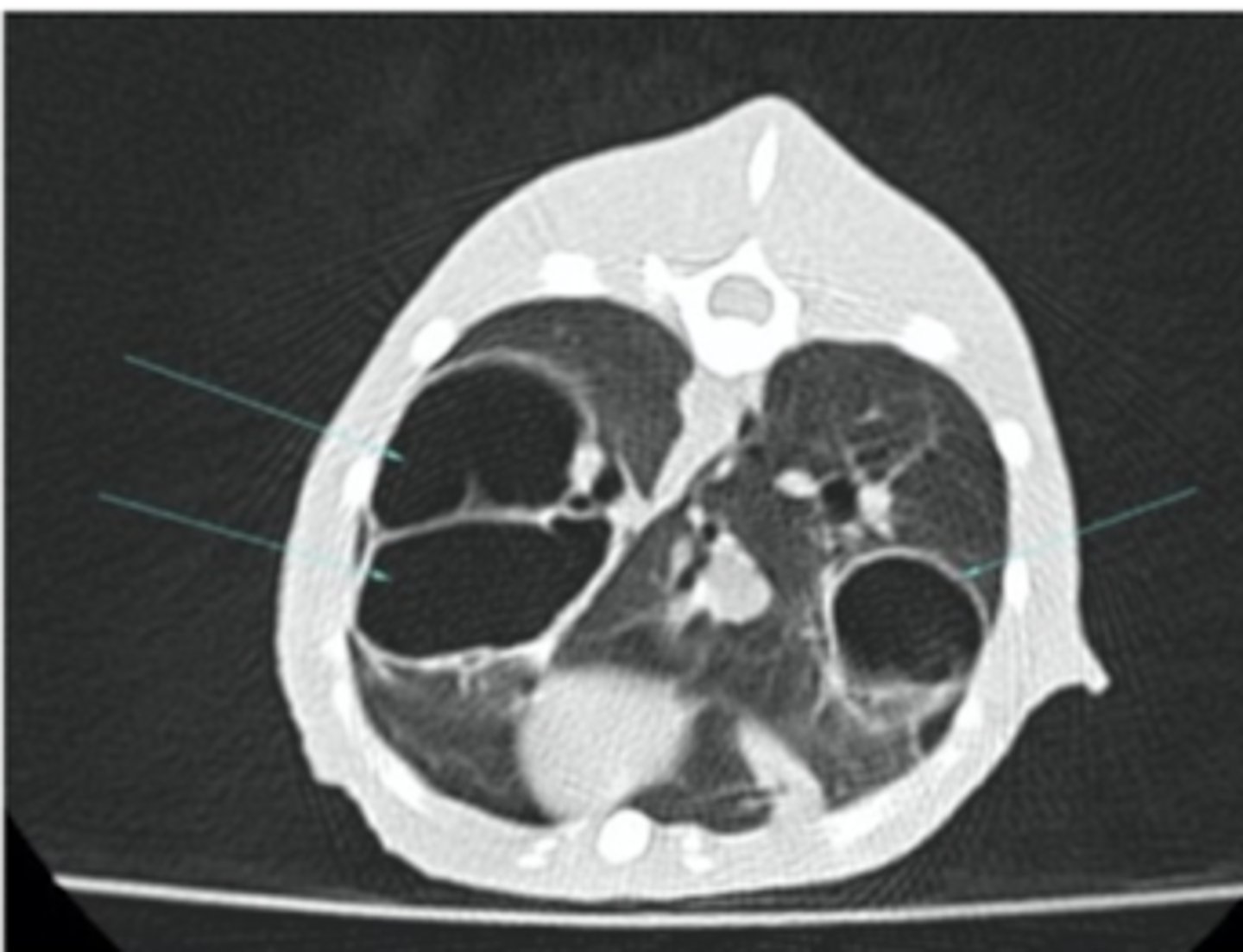 <p>what diagnostic imaging technique was used to create this image?</p>