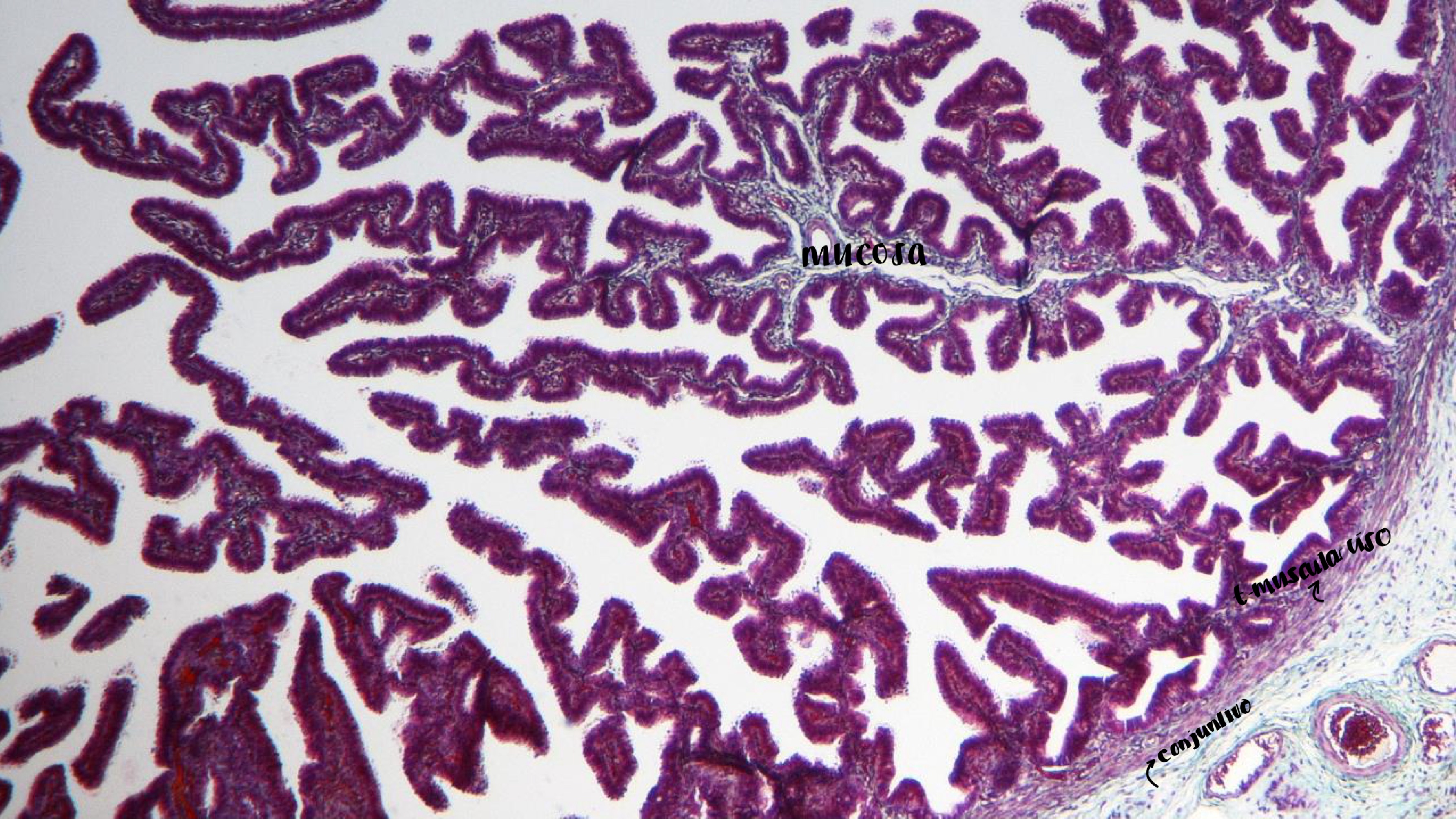 <p>trompa de falopio </p>