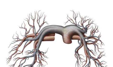 <p>a bifurcation from the pulmonary trunk</p>