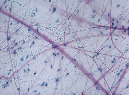 type of connective tissue, function, and location? (and what are the lines?)