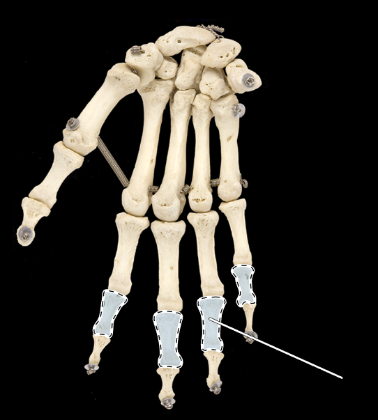 <p>Name this group of bones (be specific).</p><p>(Anterior view, right side).</p>