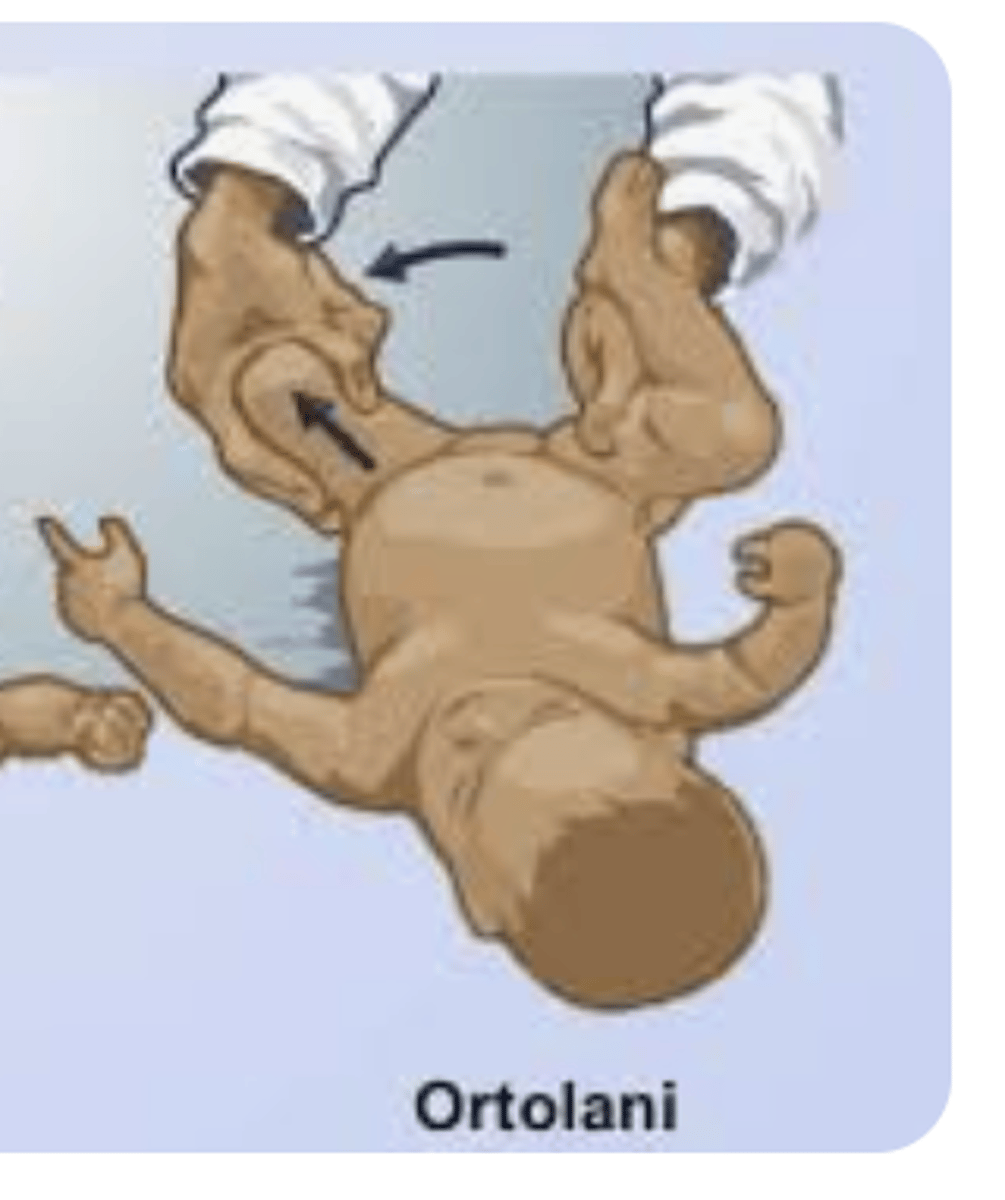 <p>Flex Hips/Knees + Abduct</p><p>(+) = relocation</p>