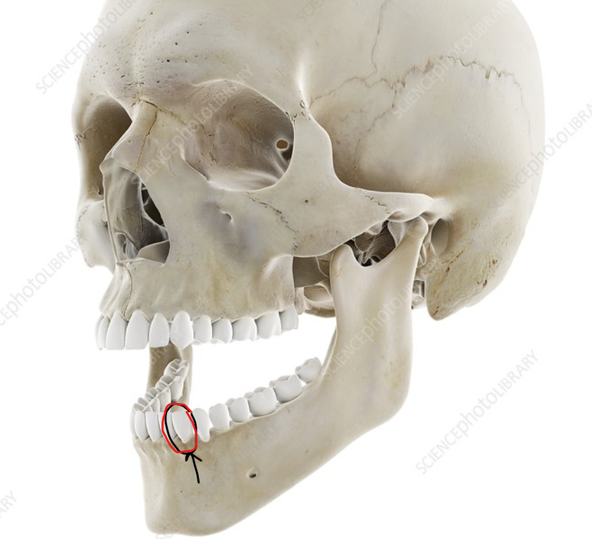 <p>what type of joint is this?</p>