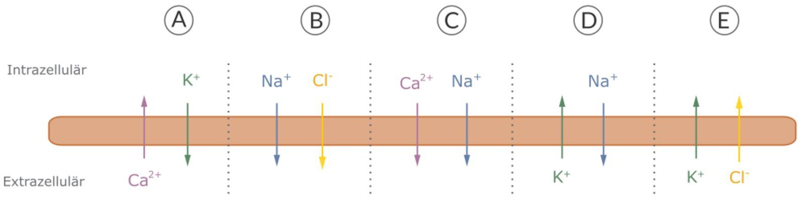 <p>68. The cortical spreading depolarization plays, among other things, a role in the development of the migraine aura. It is a process in which neurons of the brain are rapidly and almost completely depolarized. This depolarization can last about one minute and suppress brain electrical activity for several minutes.</p><p>Which of the ion movements shown here is, based on your knowledge of the ion currents during the formation of an action potential, most likely responsible for the suppression of brain activity?</p><p>A. (A)</p><p>B. (B)</p><p>C. (C)</p><p>D. (D)</p><p>E. (E)</p>