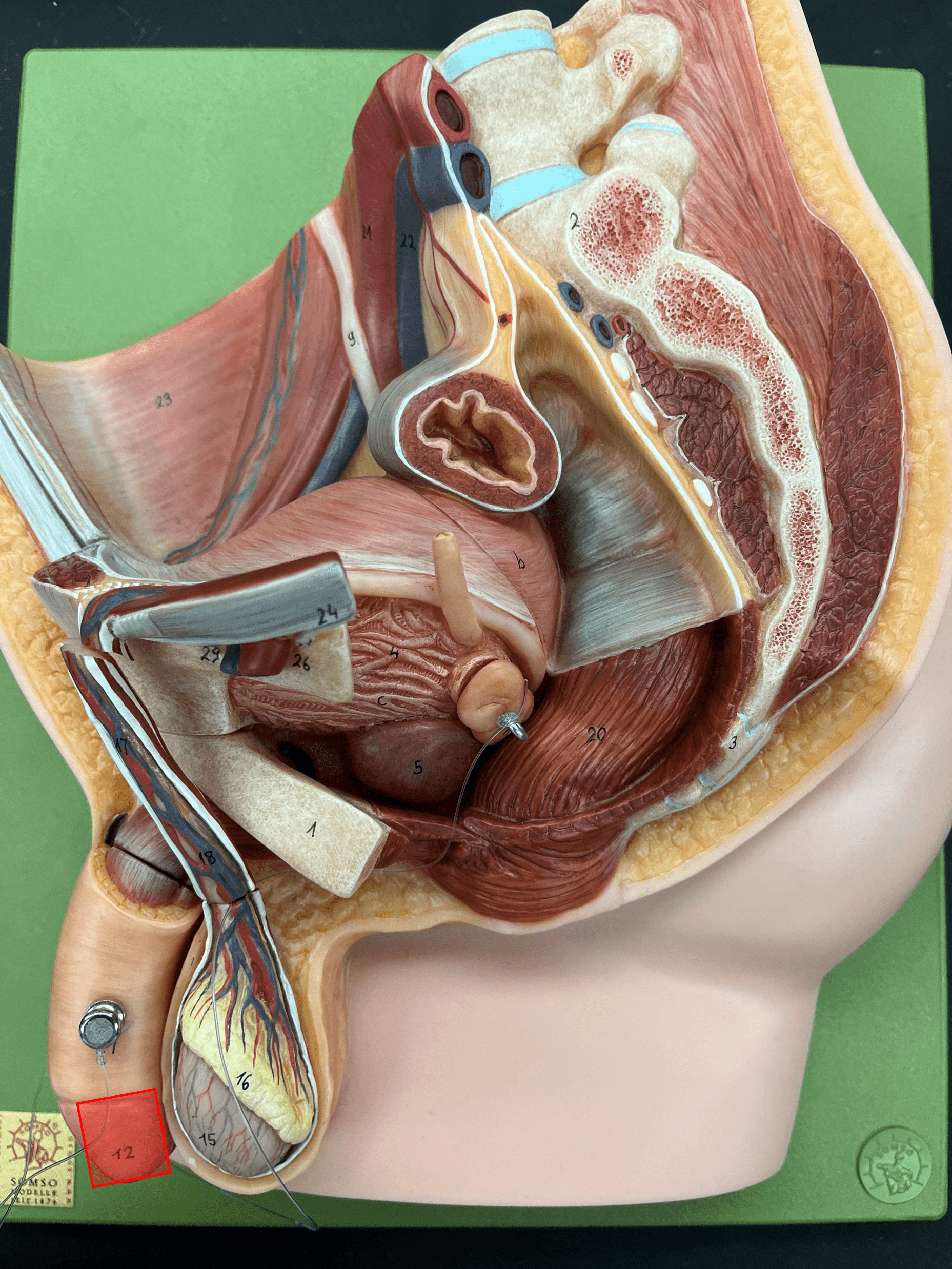 • A region of the penis.

• The enlarged distal end.
