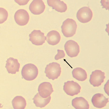 <p>What is the shape of this erythrocyte?</p>