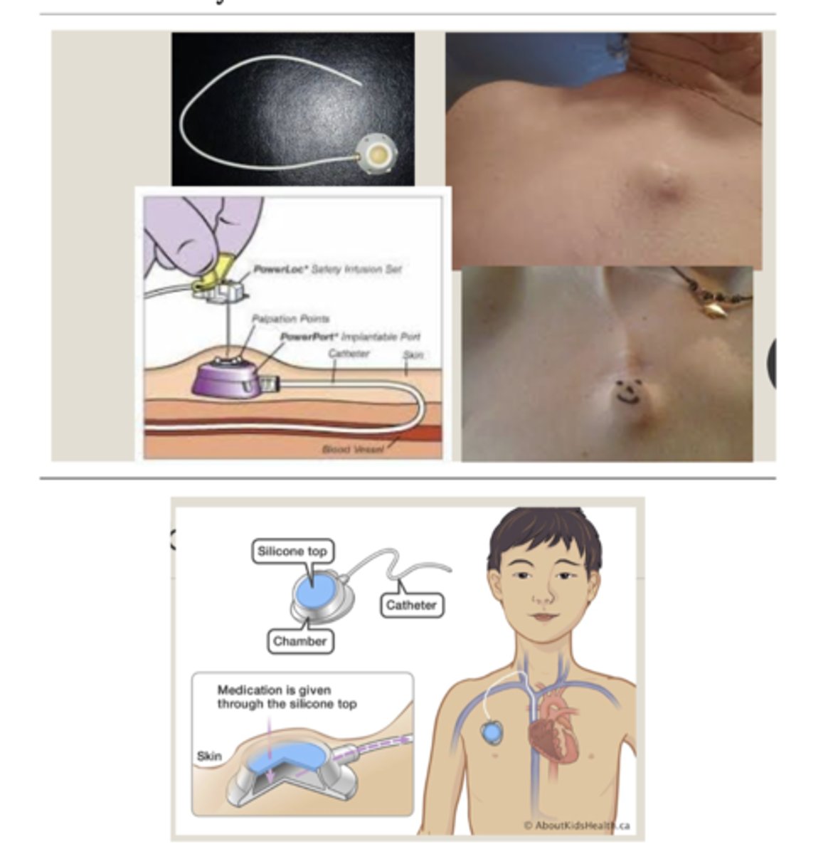 <p>How is chemotherapy delivered?</p>