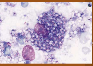 <p><span style="color: rgb(255, 255, 255);"><span>Histoplasma capsulatum</span></span></p>