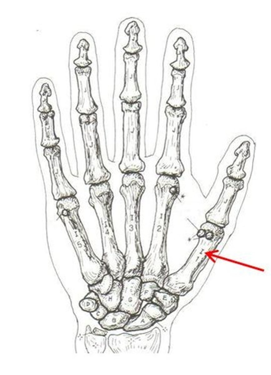 <p>ID bone</p>