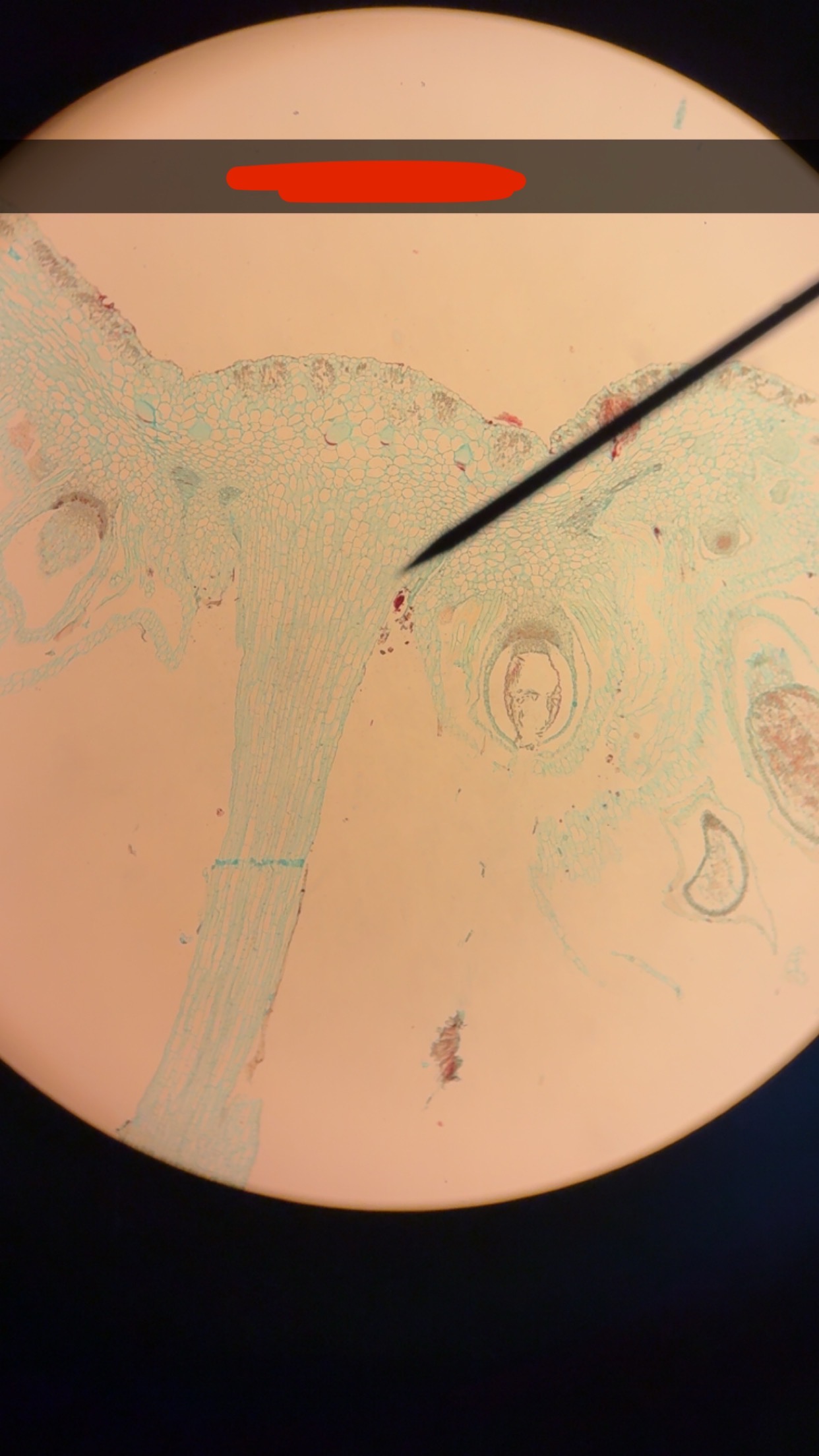 <p>What phylum </p>