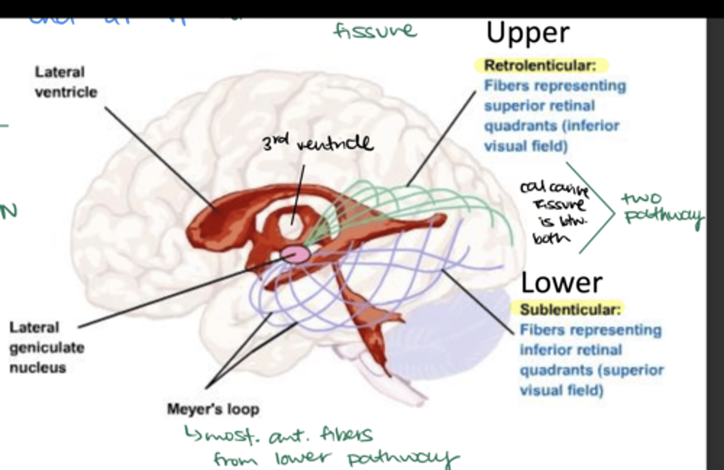 <p>Upper or superior retinal quadrants; inferior visual field</p>