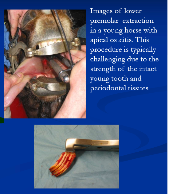 <ul><li><p>indications include infection, fracture, loose tooth, malposition, dental tumors </p></li><li><p>extraction can be challenging depending on age of horse, and nature extent and location of disease </p></li><li><p><strong>intraoral extraction preferred; sinus trephination or sinus flap with repulsion, and lateral buccotomy, are more challenging and prone to complications </strong></p></li></ul><p></p>