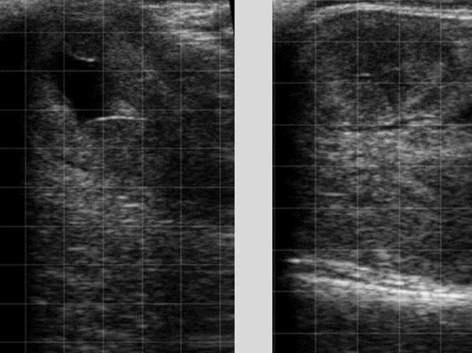 <p>will see PVD week 5 post-calving</p><p>sensitivity=85%, specificity 51%</p>