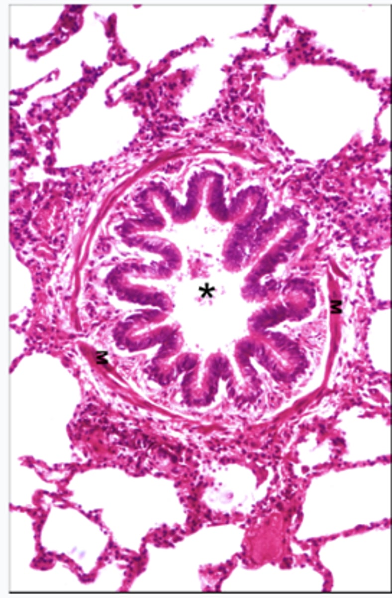 <p>This is a micrograph of which structure?</p>
