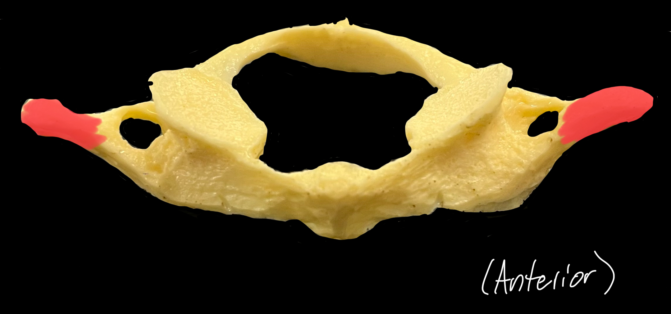 What is highlighted in red?

What muscle originates here?

What muscle inserts here?