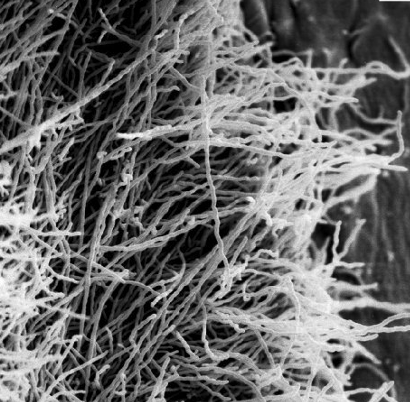 <p>what fungi part is this</p>
