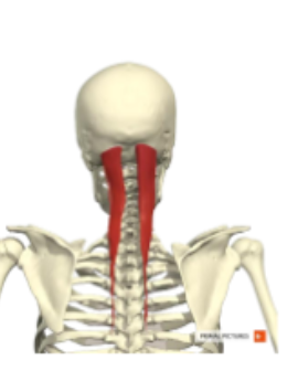 <p><span>M. semispinales capitis </span></p>