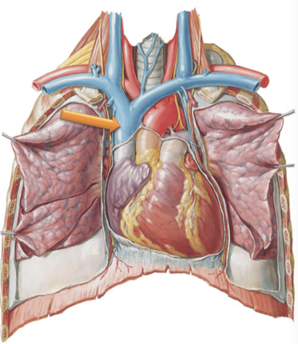 <p>Major Vessel that drains the head, neck, and upper limbs.</p>