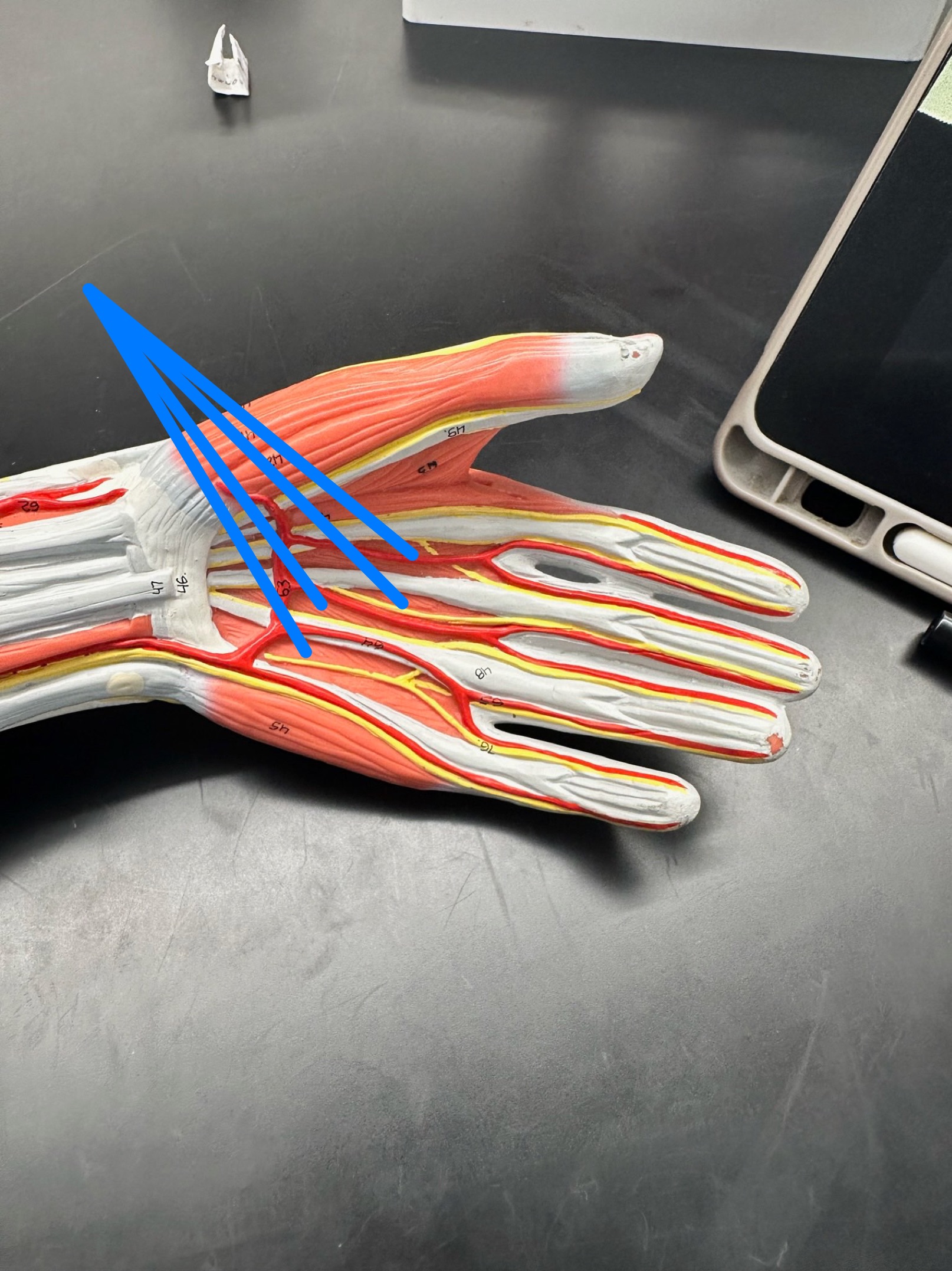 <p>ID muscle </p>