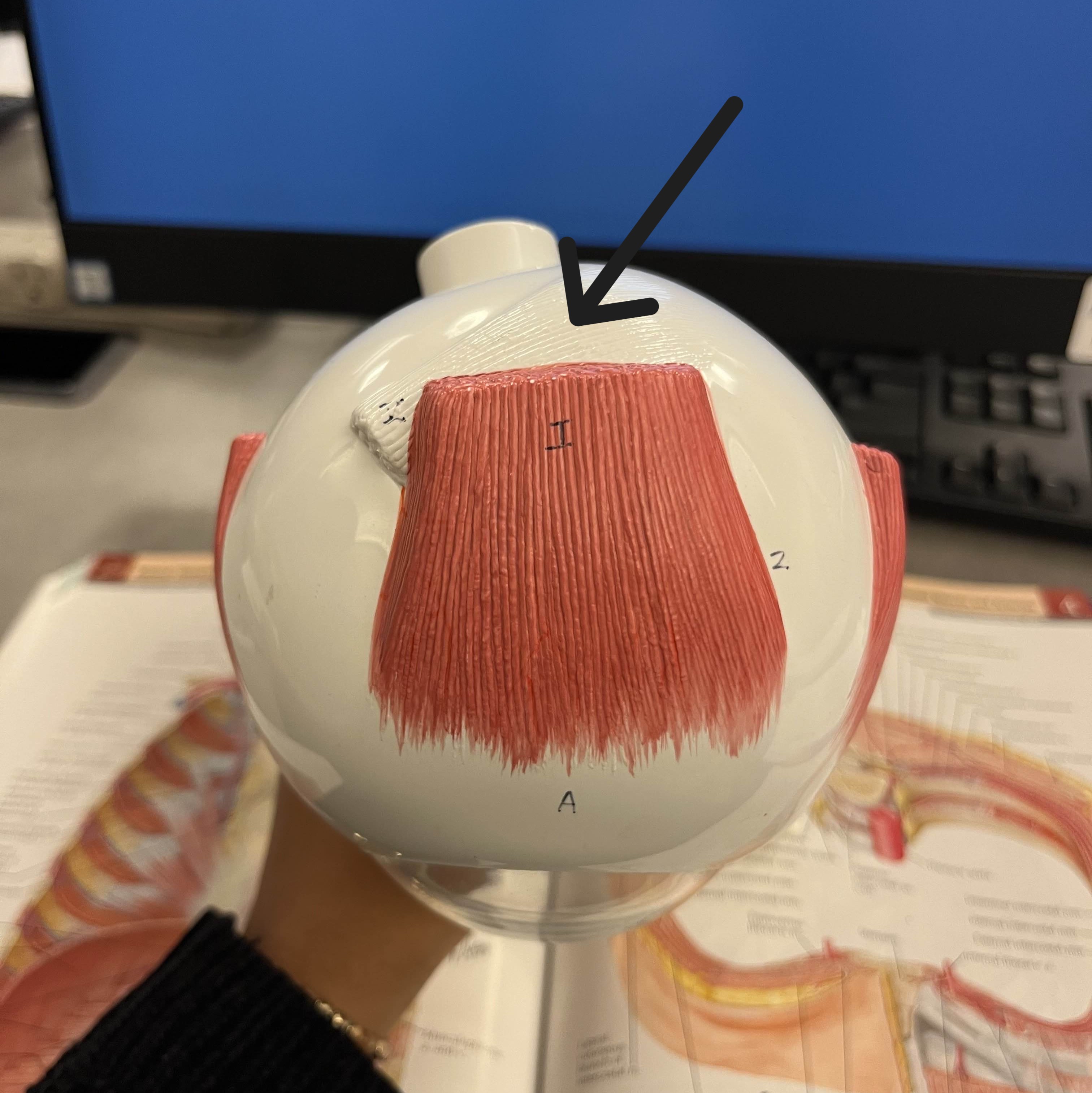 <p>Which muscle of the eye is:</p><ul><li><p>Under the superior rectus</p></li><li><p>Action: eye looks down &amp; lateral</p></li><li><p>Nerve: <span style="color: yellow;">CN IV</span></p></li></ul><p></p>