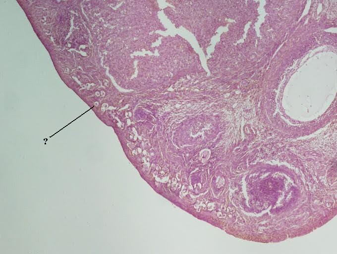 <p><span><span>Identify the indicated structure within the ovary.</span></span></p>