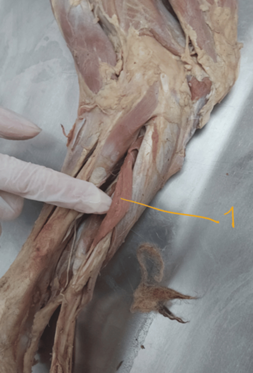 <p>identify this muscle.</p>