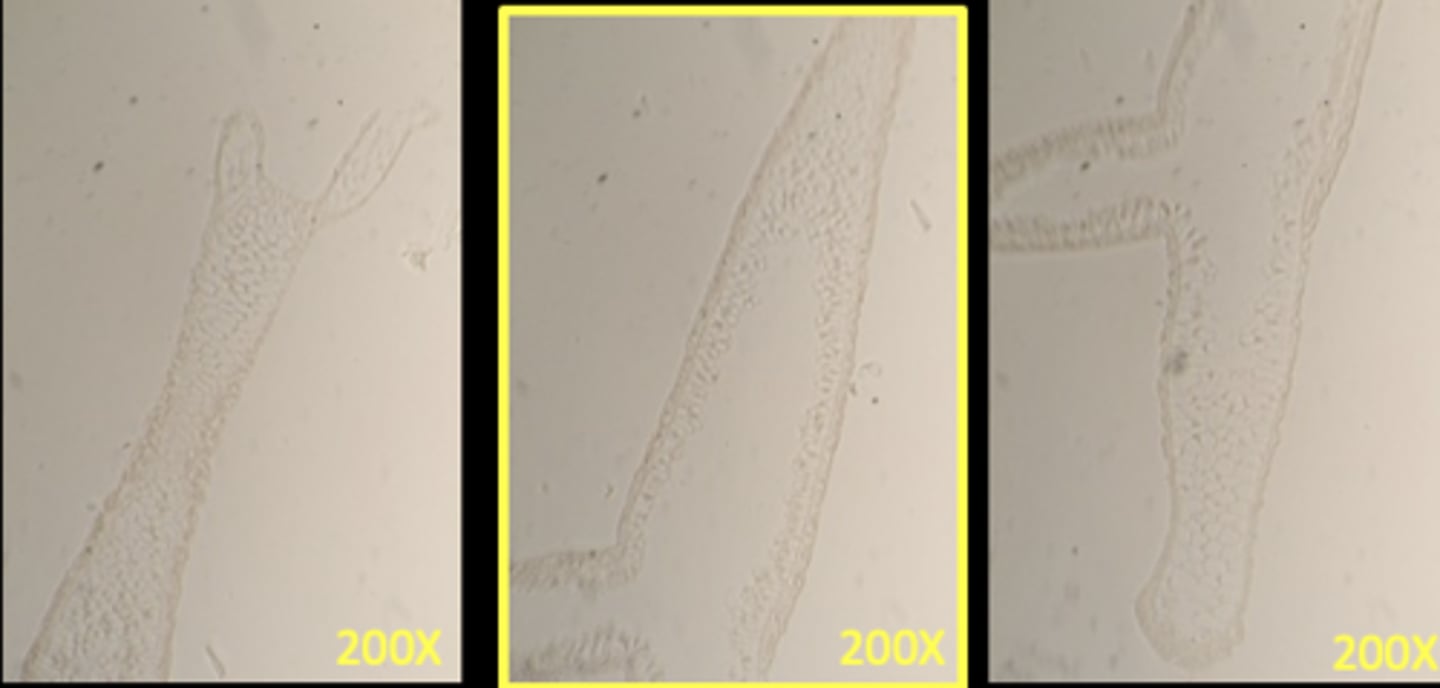 <p>Phylum: Cnidaria</p><p>Class: Hydrozoa</p><p>Genus: Hydra</p><p>Hydra l.s. (longitudinal section)</p><p>These photos are taking in succession moving down the slide to capture entire hydra l.s.</p>