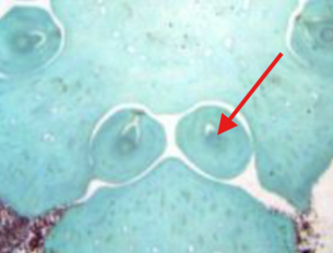 <p>What is being indicated on the Zamia Megastrobilus?</p>