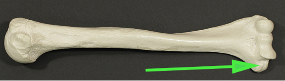 <p>Identify the portion of the humerus marked by the green arrow.</p>