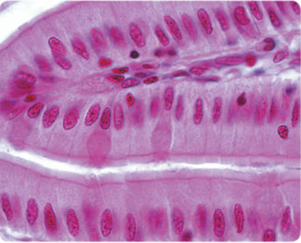 <p>It is a covering or lining tissue. The outer layer of the skin is epithelial tissue. Organs including the heart, kidney, intestines, liver and lungs are epithelium. It is also lines the inside of organs, so the inner layer of the heart, stomach, intestines and other hollow organs is made up of epithelium. The cells that make up epithelium are very closely joined together. They vary in shape from thin and flat to column-shaped and cube-shaped, depending on the particular tissue. </p>