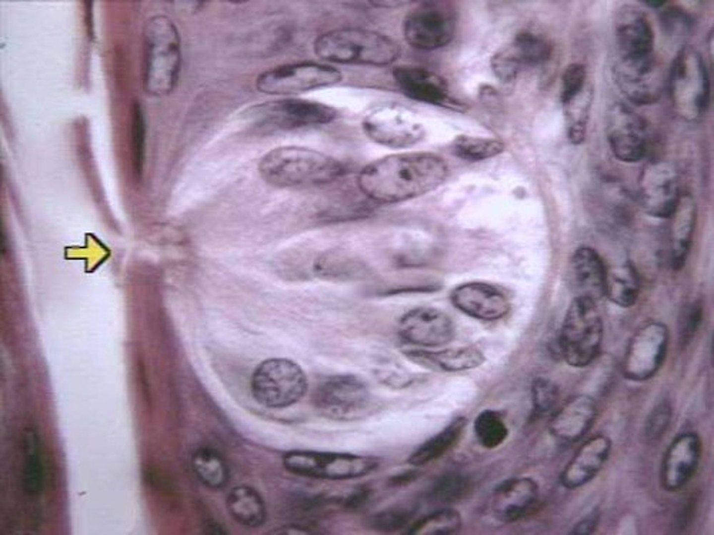 <p>opening in taste bud</p>