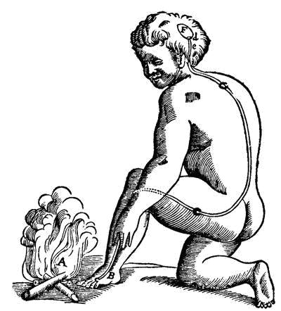 <p>what pain paradigm is described in this picture?</p>