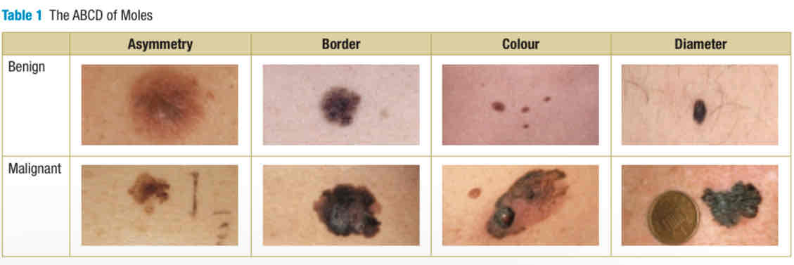 <p>check own skin using ABCD, Asymmetry, Border, Color, and Diameter</p>