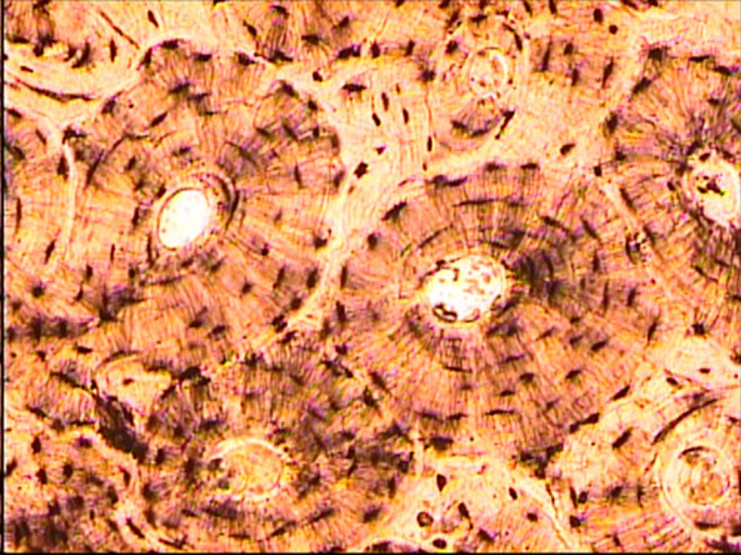 <p>individual bone cells that form concentric rings around the central canal (major component of an Osteon)</p>