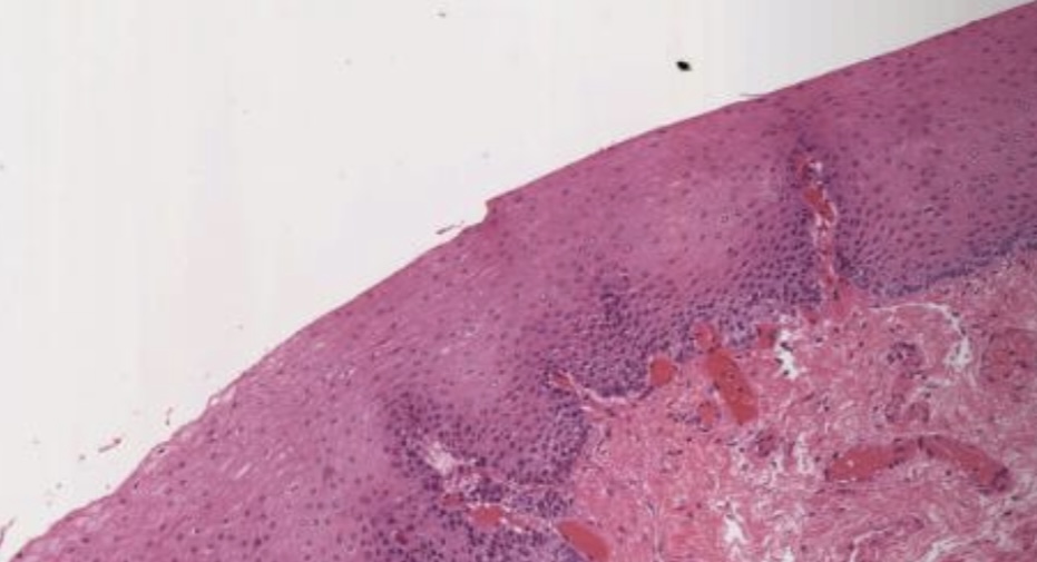 <p>What is this type of epithelium?</p>