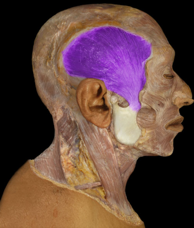 <ul><li><p>Action: Elevation of mandible (e.g., closing mouth), Retraction of mandible</p></li><li><p>Origin: Temporal fossa (formed by parts of frontal, parietal, sphenoid (greater wing), and temporal bones)</p></li><li><p>Insertion: Mandible (coronoid process and ramus)</p></li><li><p>Innervation: Trigeminal nerve (mandibular division - CN V3)</p></li></ul><p></p>