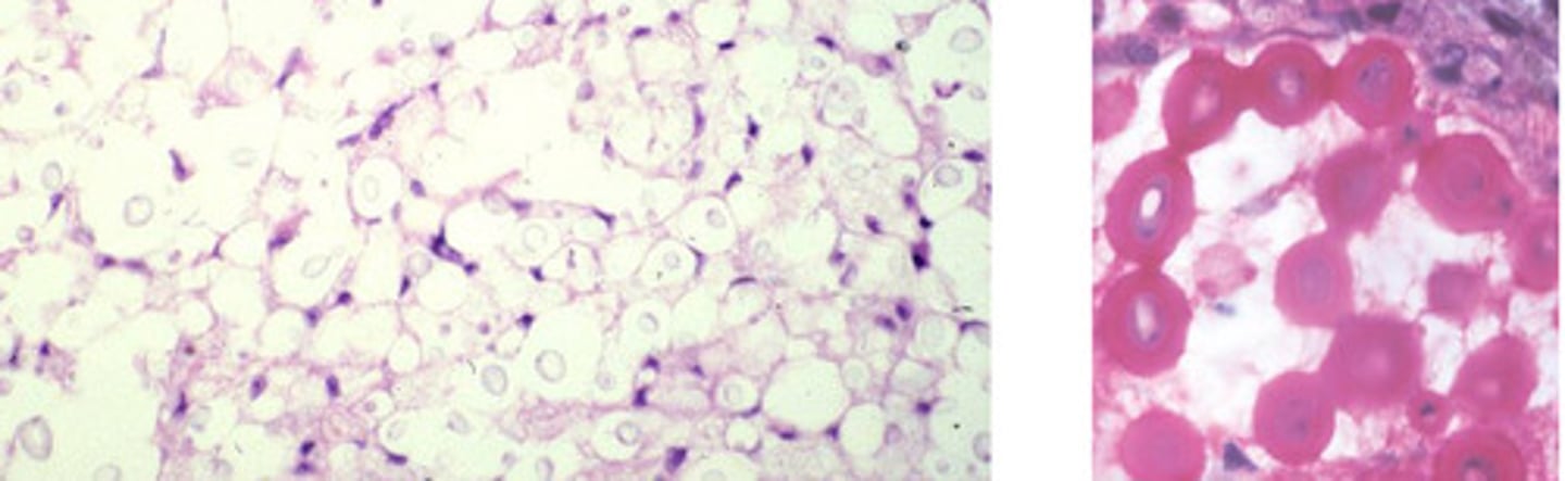 <p>Identify the pathogen?</p>