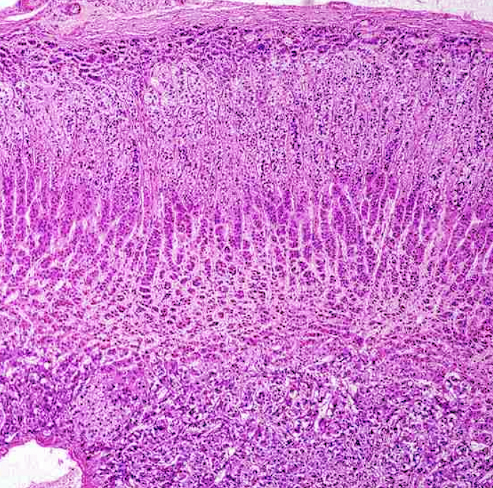 <p><span>Observe the histological pattern of this specimen and select the correct identification from the list.</span></p><p><span>a) adrenal gland</span></p><p><span>b) thyroid gland</span></p><p><span>c) pituitary gland</span></p><p><span>d) parathyroid gland</span></p><p><span>e) pancreas</span></p>